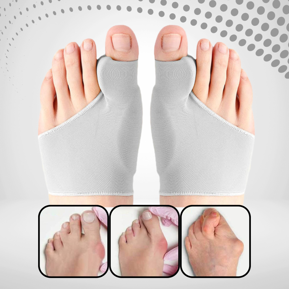 Orthofeet Correcteur D'oignon - Séparateur et correcteur d'orteils