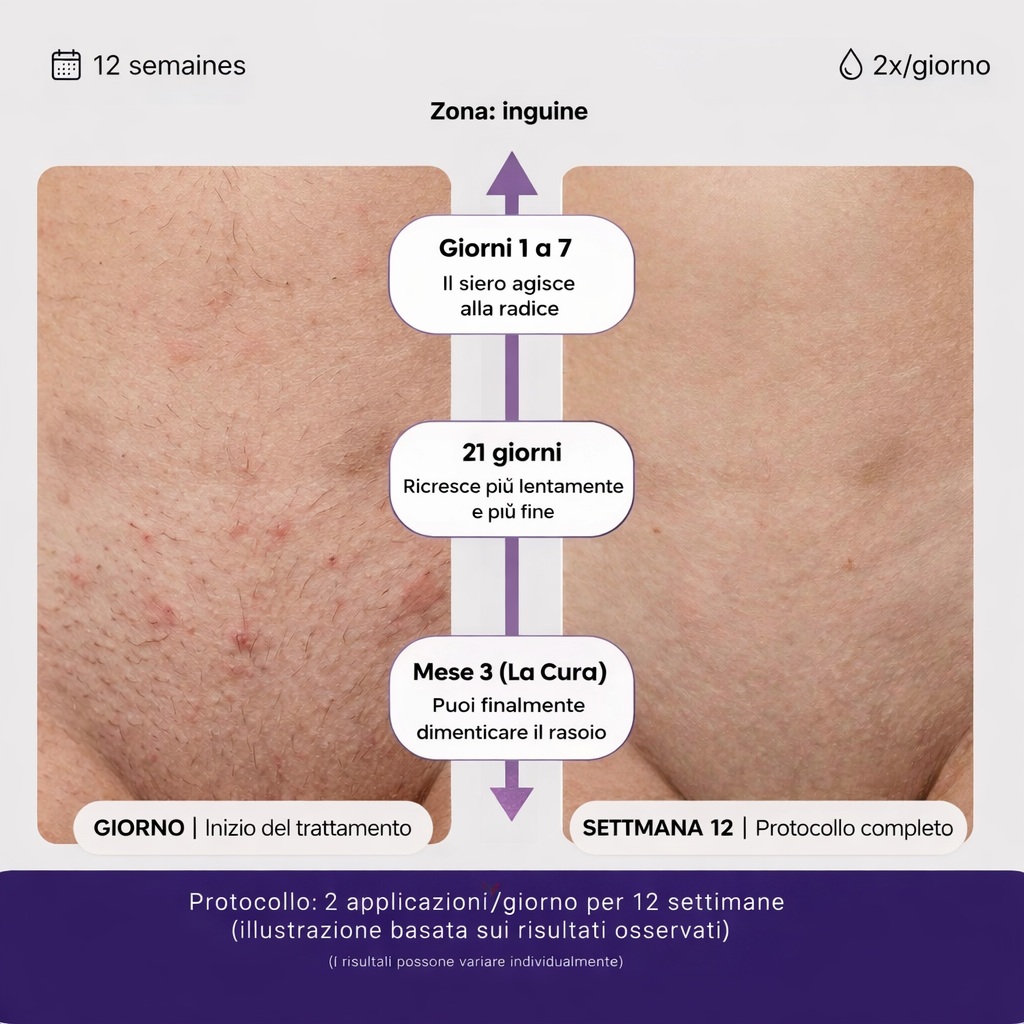 Siero Anti-Ricrescita — L’Alternativa al Laser