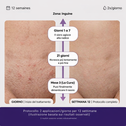 Siero Anti-Ricrescita — L’Alternativa al Laser