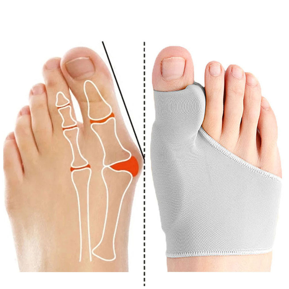 Orthofeet Correcteur D'oignon - Séparateur et correcteur d'orteils